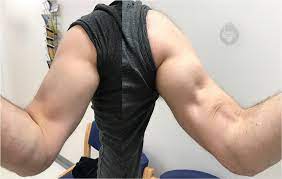 distal biceps rupture