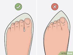 heal a bruised toenail quickly