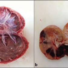 hydronephrosis in dogs enlarged kidney
