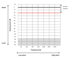 Audiogram Low Pitch Report Template High Pitch