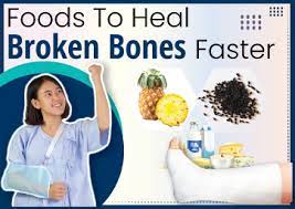 foods to heal broken bones faster