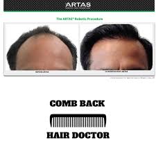 Whether you live in the san diego area or are traveling into town from oceanside or chula vista, our experienced physicians and trained counselors are ready to help you find the right solution. Hair Restoration San Diego Hair Restoration San Diego
