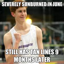 severely sunburned in June still has tan lines 9 months later ... via Relatably.com