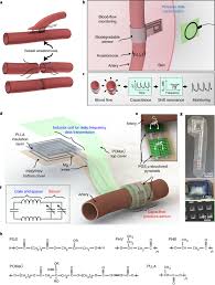 There are three types of arteries, including elastic arteries, muscular arteries and like any other part of the body, arteries and veins are subject to disorders that may be caused by birth deformities, poor health or older age. Biodegradable And Flexible Arterial Pulse Sensor For The Wireless Monitoring Of Blood Flow Nature Biomedical Engineering