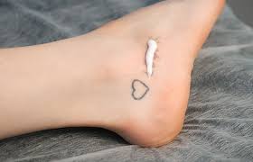 how to remove a tattoo a complete