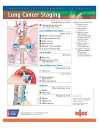 Pin On Lung Cancer