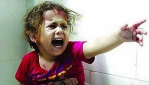 نتيجة بحث الصور عن اطفال اليمن