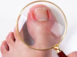 does your big toenail keep hurting