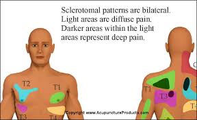 Sclerotome And Visceral Pain Chart