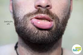 how to get rid of swollen lips 4 home