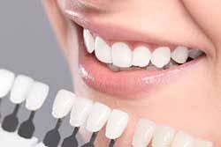 Cosmetic Dentist Chennai Porcelain Veneers Teeth Whitening