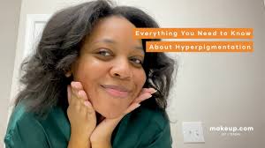 cover hyperpigmentation with makeup