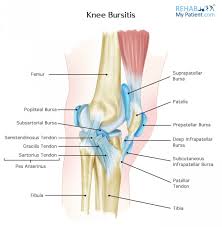 Brezilya'da günde 2 bin kişi hayatını. Knee Bursitis Rehab My Patient