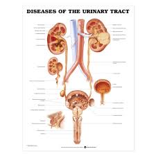 Diseases Of The Urinary Tract Chart Poster Laminated