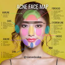 what is your acne telling you divine