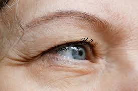 contact lenses cause drooping eyelids