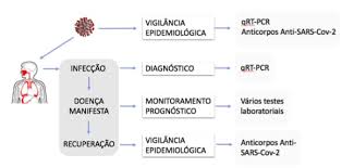 Genetic (or molecular) tests, antigen tests, and antibody tests. Alteracoes Em Exames De Pacientes Com Covid 19 Pfarma