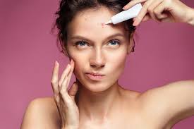 skin spectrum s top 10 tips for acne