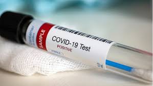Does my insurance cover any urgent care alternatives? Covid 19 Testing Centers