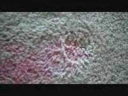 remove a red kool aid stain from carpet