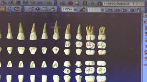 Dentrix Tutorial For Hygienists Dental Jobs Dental