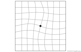how to test vision using an amsler grid