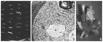 Callus Formation, Cell Suspension Culture and Plant Regeneration ...