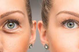 best eye creams for puffiness doctor