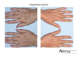 how to achieve younger looking hands