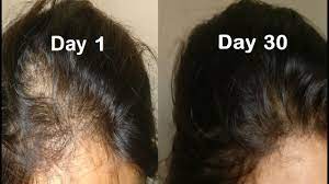 onion juice for hair regrowth get