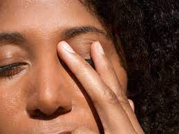 eyelid eczema treatment causes and