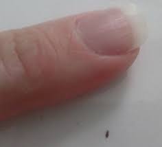 tiny bugs in bathroom doityourself