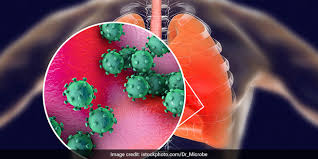Australia government department of health: Unpredictable Effects Of Novel Coronavirus On Human Body Keep Doctors Baffled News