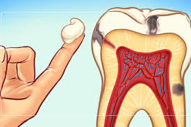 7 home remes to treat toothache htv