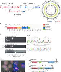 mybl1 nfib gene fusion identified in