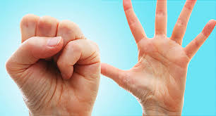 Some of the symptoms which may suggest a broken pinky finger or pinky finger fracture are severe pain in the pinky finger along with swelling and tenderness in the area. 10 Ways To Exercise Hands Fingers