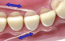 Dental Floss Wikipedia