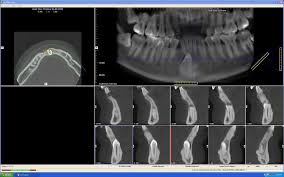 the safety of cone beam ct essetial
