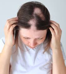 trichotillomania hair regrowth and