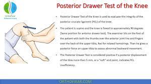 posterior drawer test of the knee