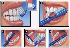Cara putihkan gigi melalui teknik yang betul sangat penting bagi mengelakkan komplikasi atau masalah pada masa akan datang. Paku Midin 5 Tips Cara Penjagaan Gigi Dengan Betul