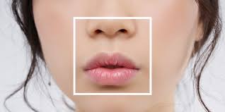 fuller lips without collagen injections