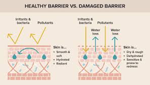 how to repair a damaged skin barrier