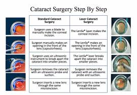 cataract patients undergoing surgery