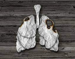 Combien de temps peut-on vivre avec un cancer du poumon ?