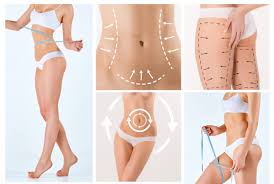 laser lipo torrance liposys s