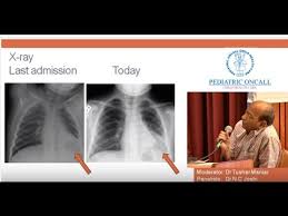 medical case study examples ip  medical case study 