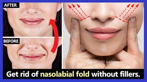 get rid of nasol folds