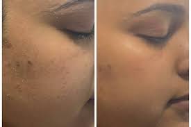 permanent makeup skin eyebrows and