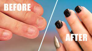 fix short bitten nails with acrylic